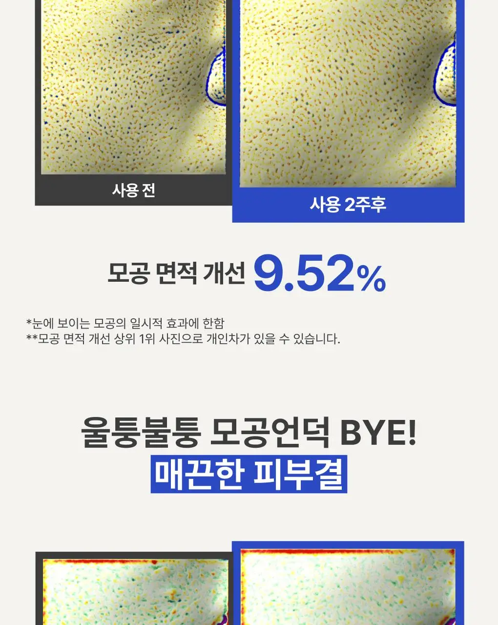 [모공속광] 이니스프리 레티놀 그린티 PDRN 스킨부스터 토너 170ml 기획 (+50ml) 상세페이지 10